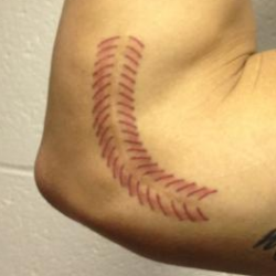 Tommy John